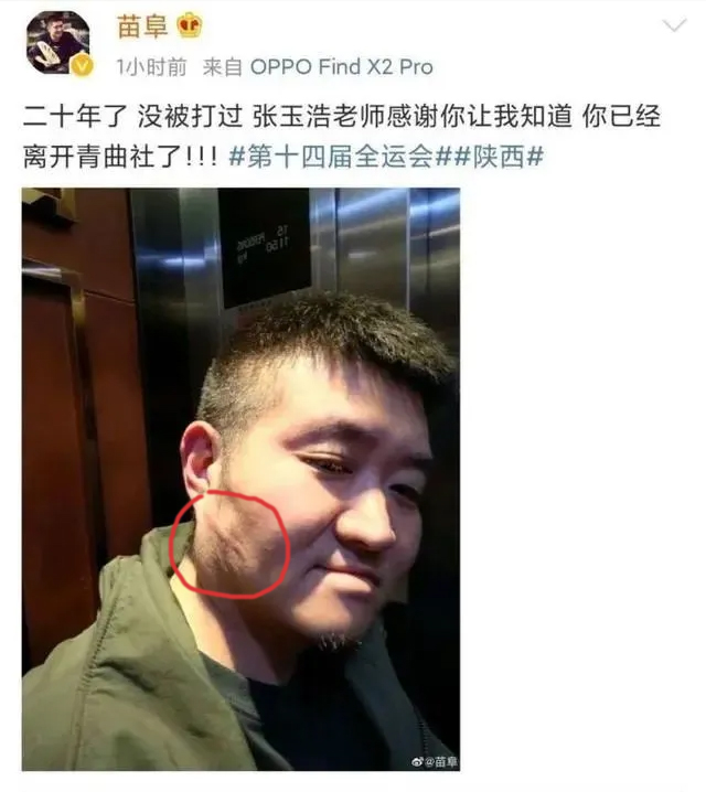 苗阜發(fā)微自爆被打后秒刪,打人者張玉浩發(fā)微“因果有循環(huán)” 相聲新勢(shì)力 青曲社 相聲 張玉浩 苗阜 3030說(shuō) 第1張 苗阜發(fā)微自爆被打后秒刪,打人者張玉浩發(fā)微“因果有循環(huán)” 相聲新勢(shì)力 青曲社 相聲 張玉浩 苗阜 3030說(shuō) 第1張
